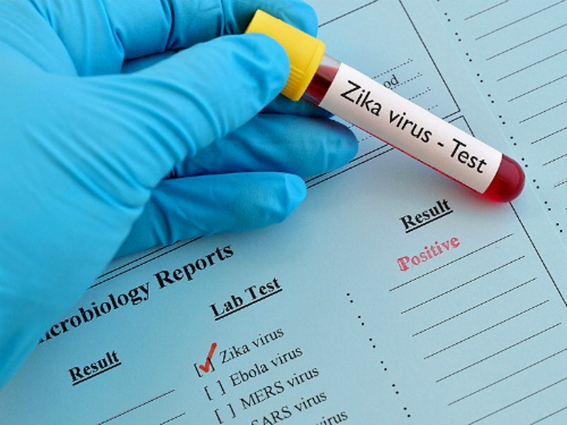 Trẻ sơ sinh có cần làm xét nghiệm virus Zika không?