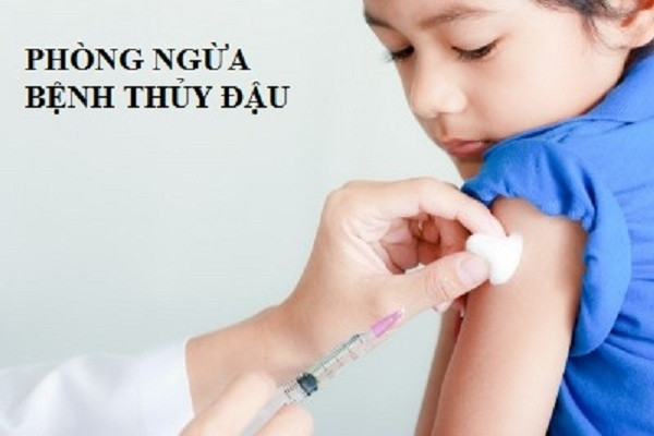 Vacxin ngừa thủy đậu