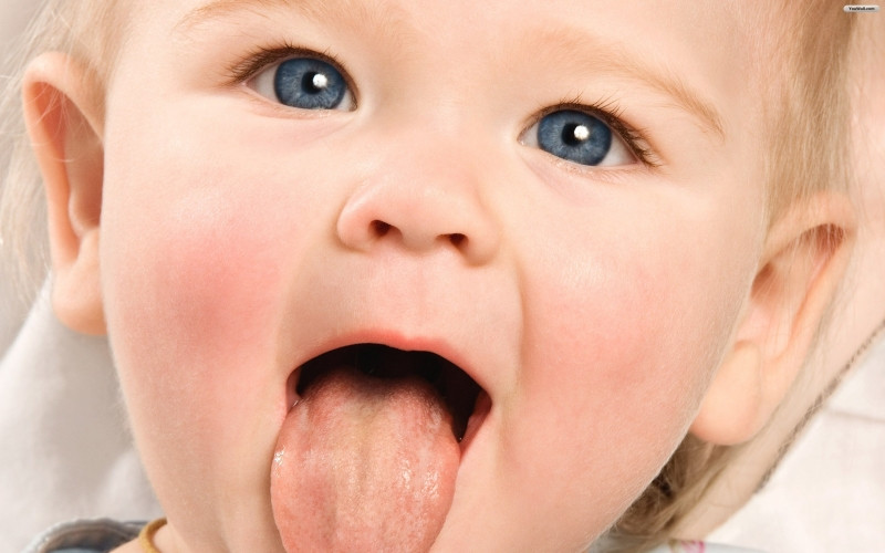 Cặn sữa, mụn sữa có thể là nguyên nhân gây vàng da ở trẻ