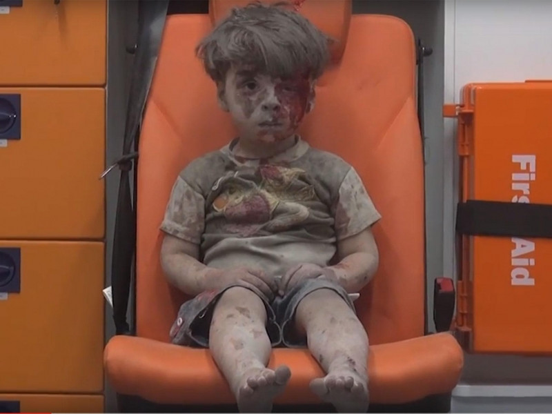 Bậu bé 5 tuổi người Syria trên chiếc xe cứu thương