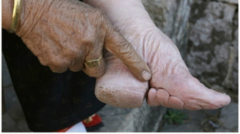 Bàn chân gót sen tượng trưng cho đức hạnh và phẩm giá của người phụ nữ phong kiến Trung Quốc