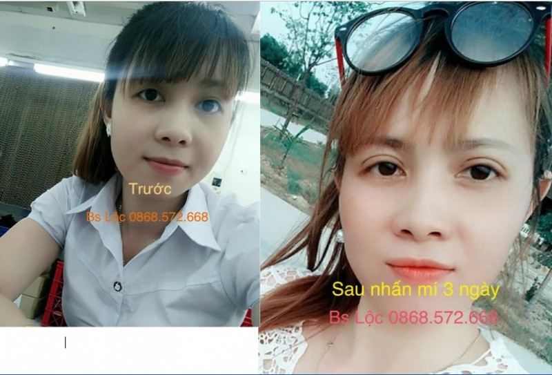 Thẩm mỹ Miss Duyên Quy Nhơn