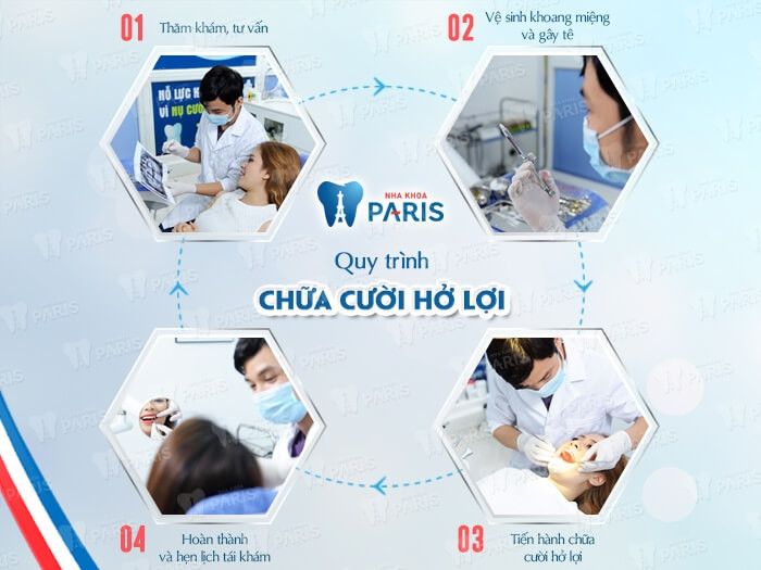 Quy trình chữa cười hở lợi tại Nha khoa Paris