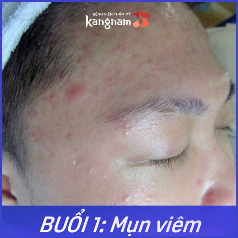 Bệnh viện thẩm mỹ Kangnam