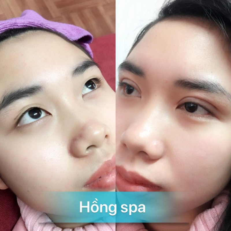 Hồng Spa