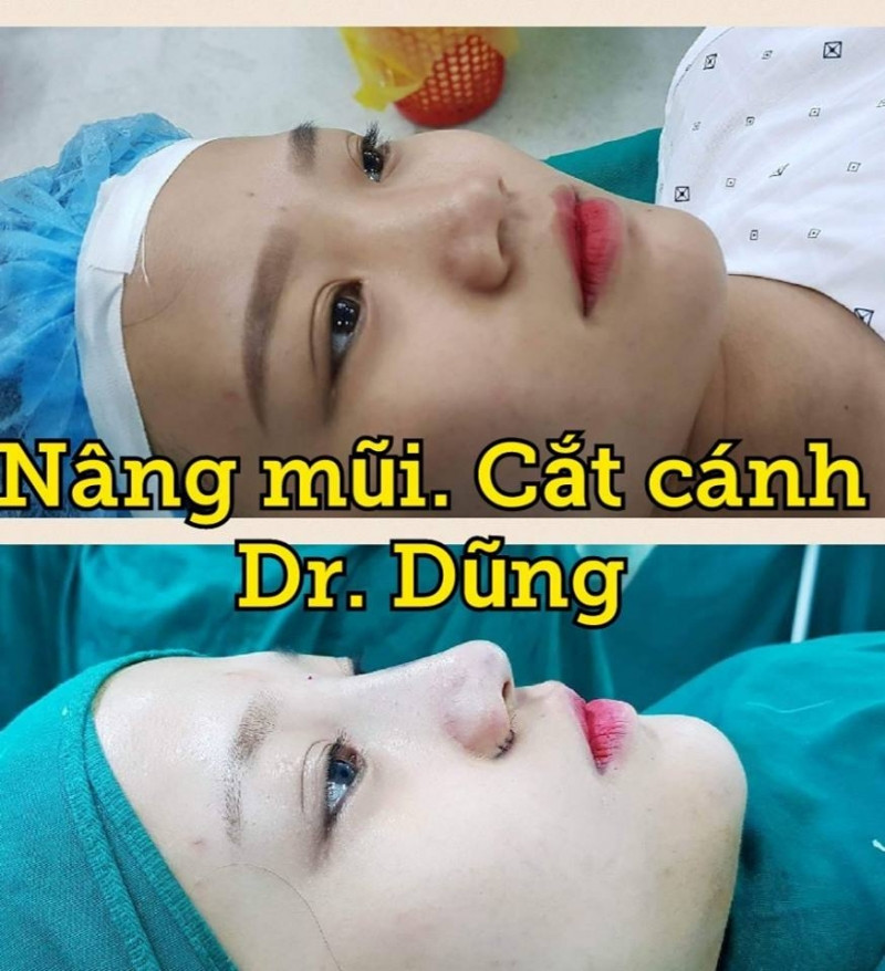 Bs Dũng - Thẩm mỹ