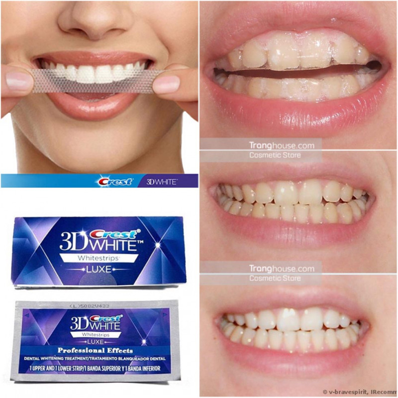 Crest 3D White Whitestrips Advanced Vivid 25X là miếng dán trắng răng thế hệ mới, cung cấp năng lượng giúp làm trắng răng gấp 5 lần so với các sản phẩm thông thường.