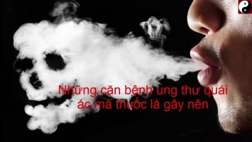 benh-ung-thu-do-hut-thuoc-la-gay-ra