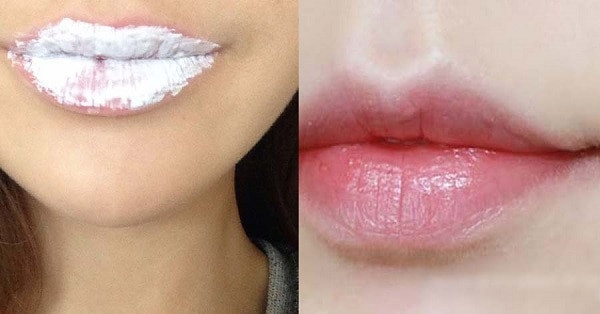 trị thâm môi bằng kem đánh răng