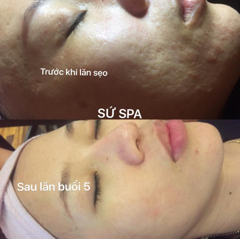 SỨ BEAUTY CENTER- Thẩm mỹ công nghệ cao