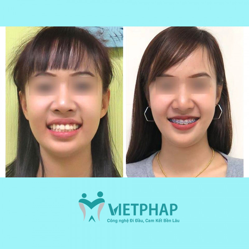 Nha khoa Quốc Tế Việt Pháp