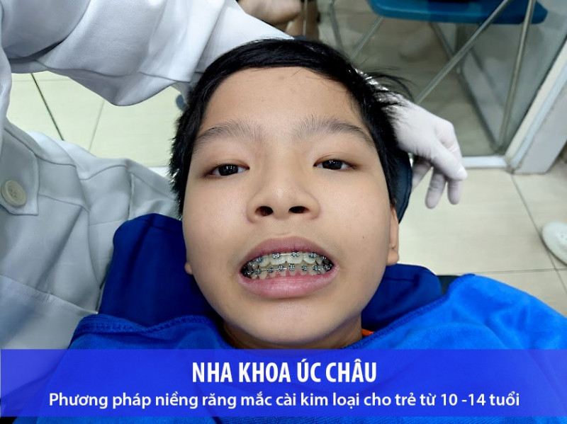 Nha Khoa Úc Châu