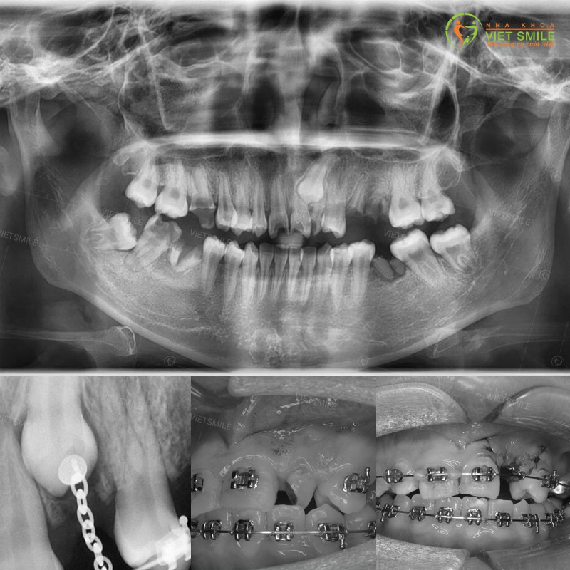 Nha Khoa VIET SMILE