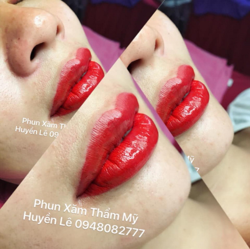 Thẩm Mỹ Huyền Lê