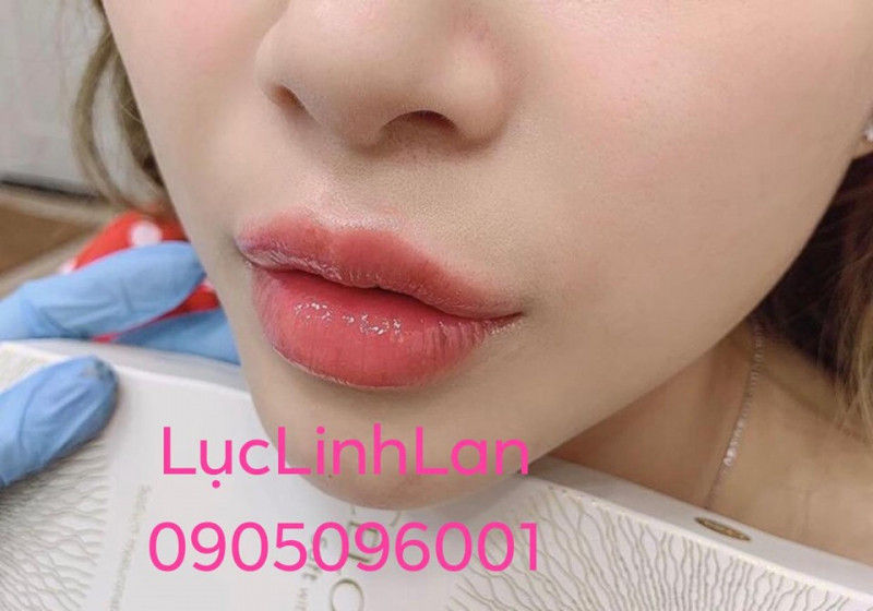 Lục Linh Lan Beauty & Clinic