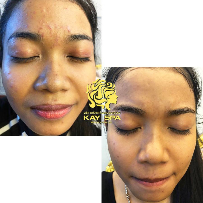 Kay Spa Q10 - Skin Care & Beauty Clinic