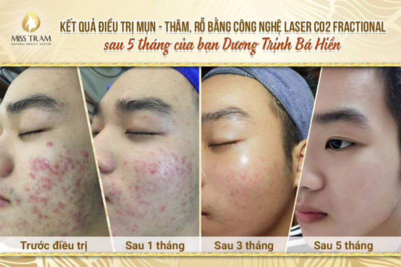 Miss Trâm – Natural Beauty Center hoạt động theo phương châm mang đến vẻ đẹp tự nhiên, hài hòa, sự hài lòng tuyệt đối cho khách hàng