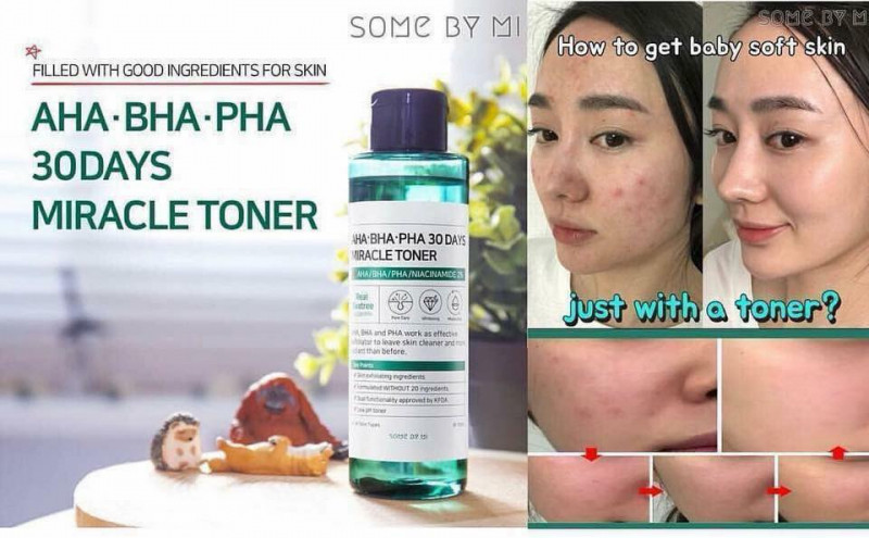 Nước hoa hồng trị mụn Some By Mi AHA-BHA-PHA 30 Days Miracle Toner 150ml.