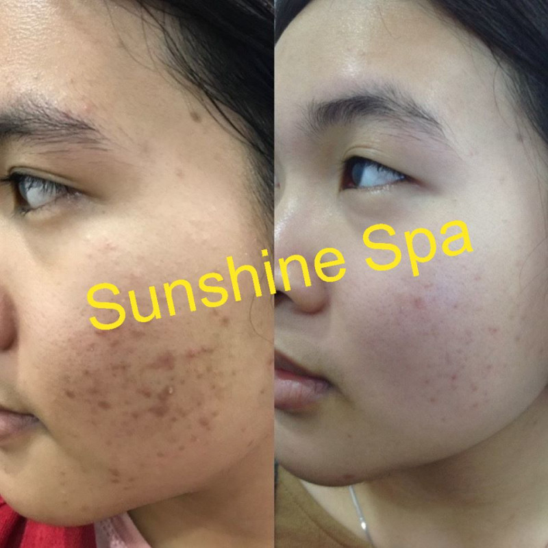Sunshine Spa tập trung chuyên sâu vào quá trình phục hồi, cải tạo làn da, vóc dáng của chị em phụ nữ.