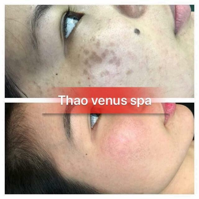 Thảo Venus Spa