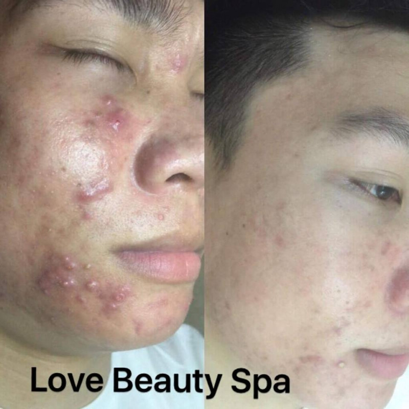 Love Beauty Spa-Quảng Ninh