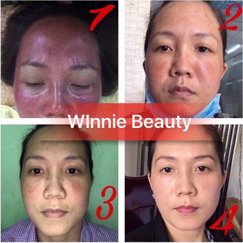 Giang Winnie Beauty & Spa