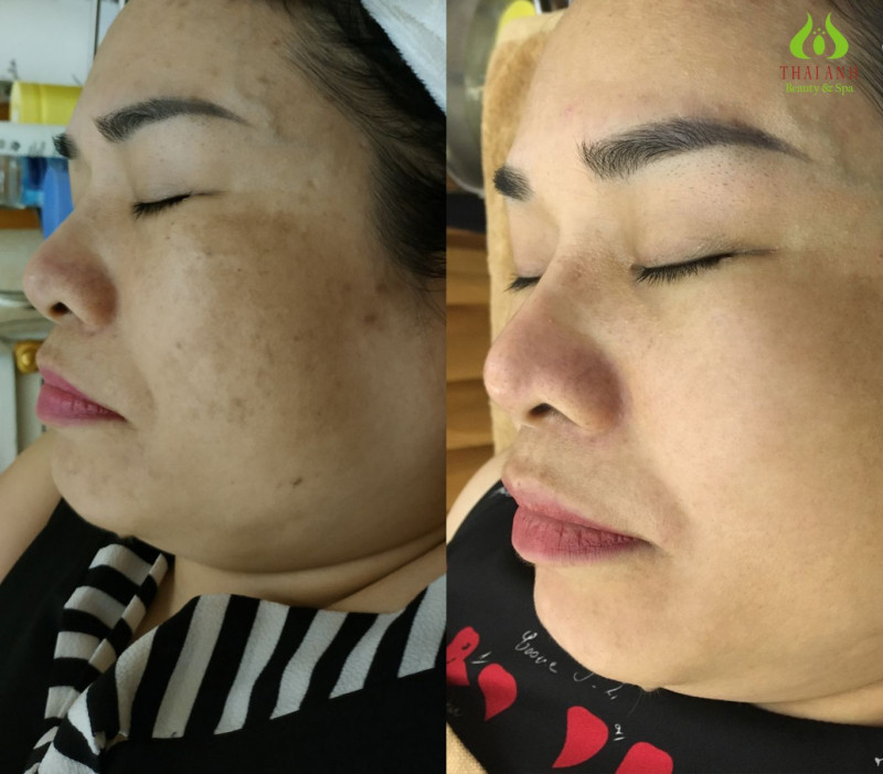 Thái Anh Beauty & Spa