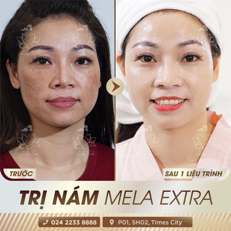 Viện Thẩm Mỹ Quốc Tế Lady Sabi