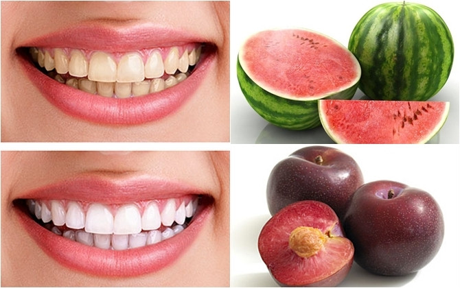 Ăn nhiều trái cây có lượng axit tự nhiên, giàu chất xơ giúp loại bỏ những mảng bám và làm răng trắng sáng hơn