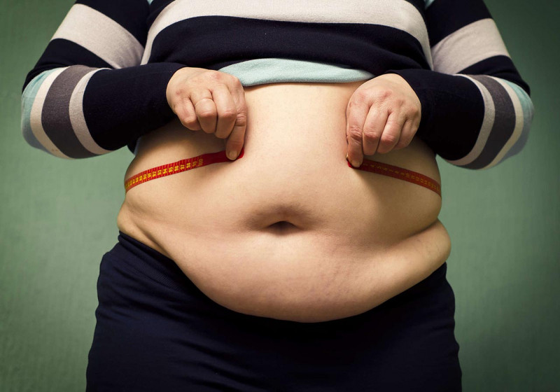 Người béo phì dễ bị mắc bệnh trĩ