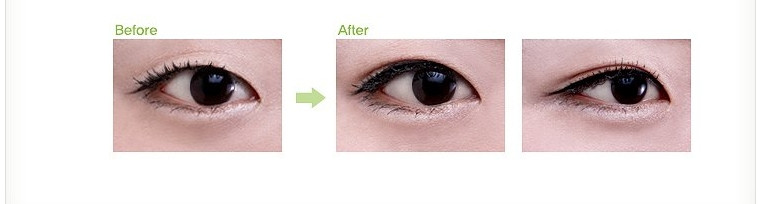 Thay đổi sau khi sử dụng Eyelid Tape