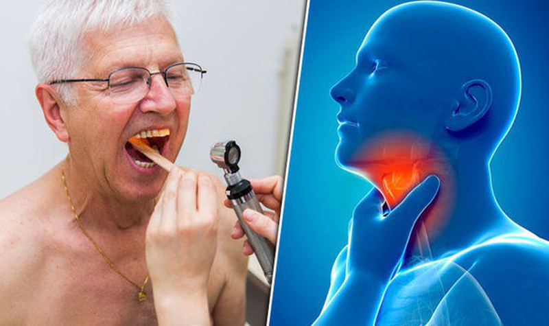 Đau họng, ho rát họng thường xuyên có thể do viêm họng mãn tính hoặc ung thư vòm họng