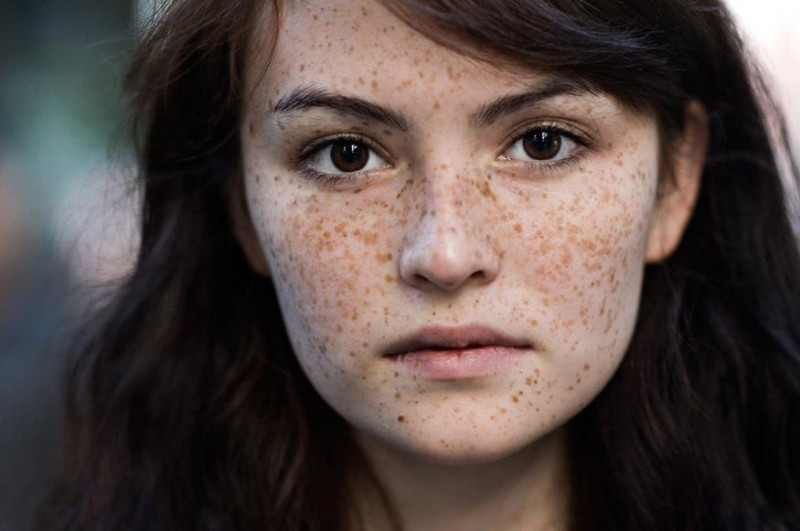 Vết thâm nám xuất hiện cho thấy làn da của bạn có dấu hiệu lão hóa