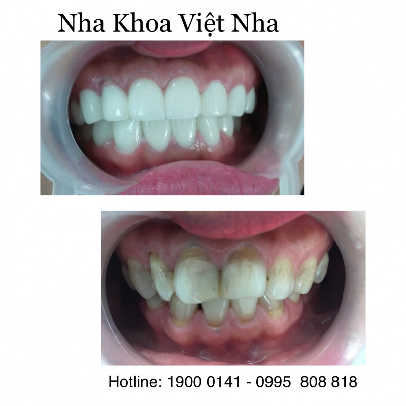 Nha Khoa Việt Nha