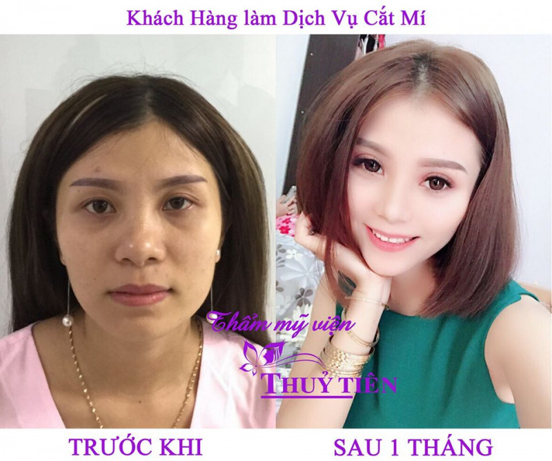 Thẩm Mỹ Viện Thủy Tiên