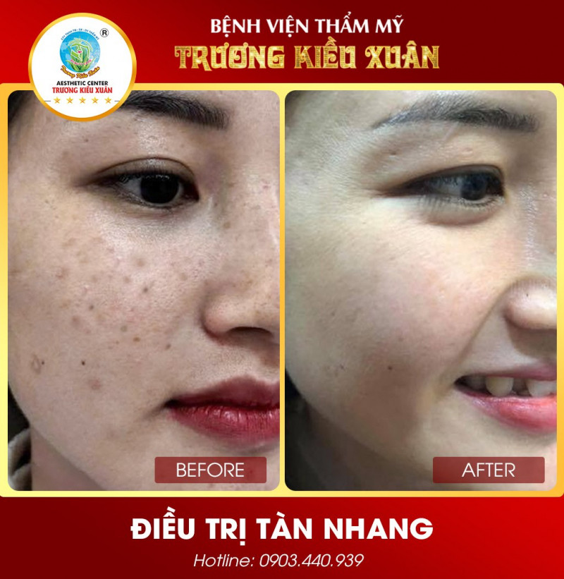 Thẩm mỹ viện Trương Kiều Xuân