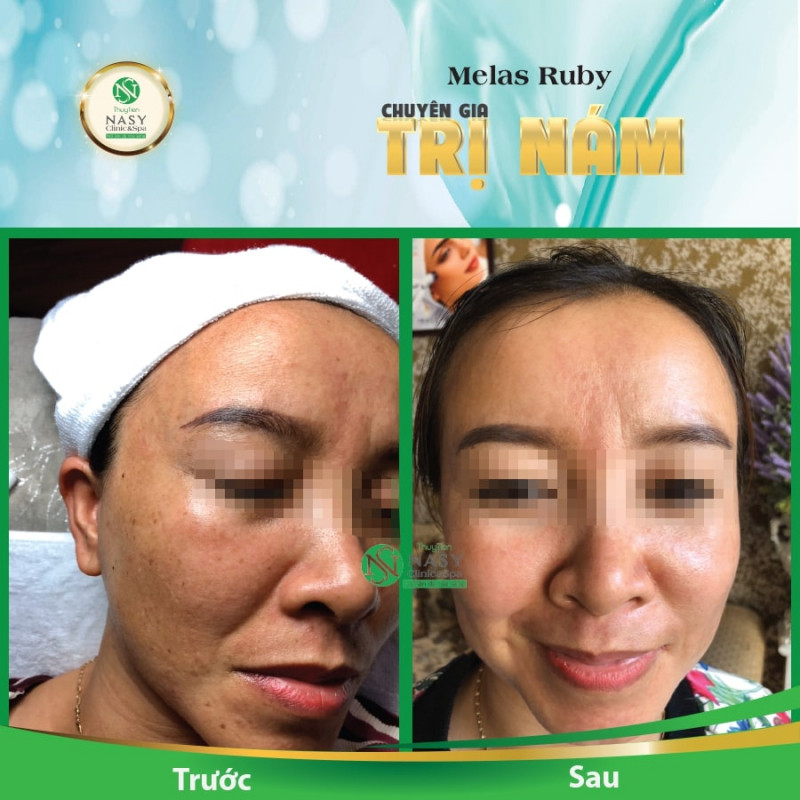 Thủy Tiên Nasy Clinic & Spa