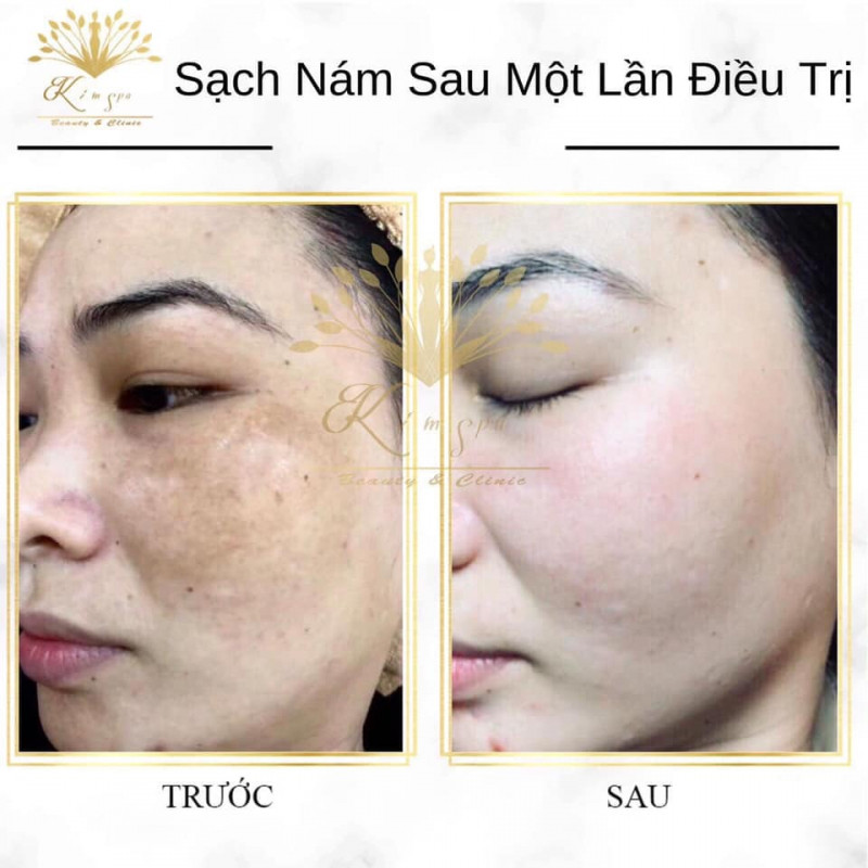 Kim Spa Gia Lai