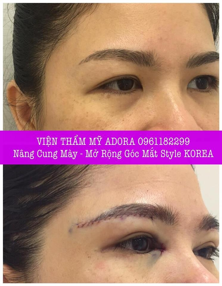 Viện Thẩm Mỹ ADORA