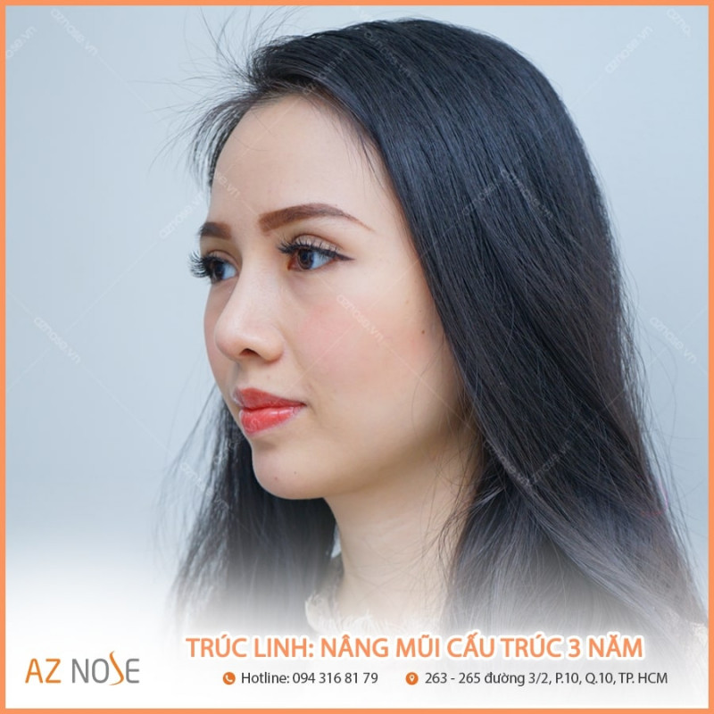 Phòng khám chuyên nâng mũi AZ NOSE