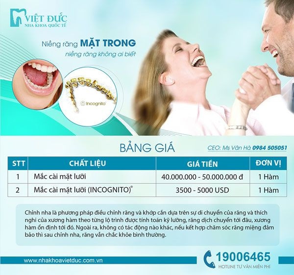 Bảng giá niềng răng mặt trong tại nha khoa Việt Đức