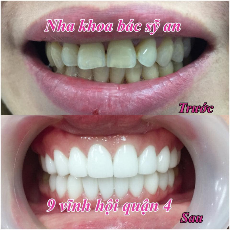 Nha khoa thẩm mỹ bác sĩ An