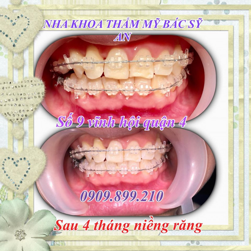 Nha khoa thẩm mỹ bác sĩ An