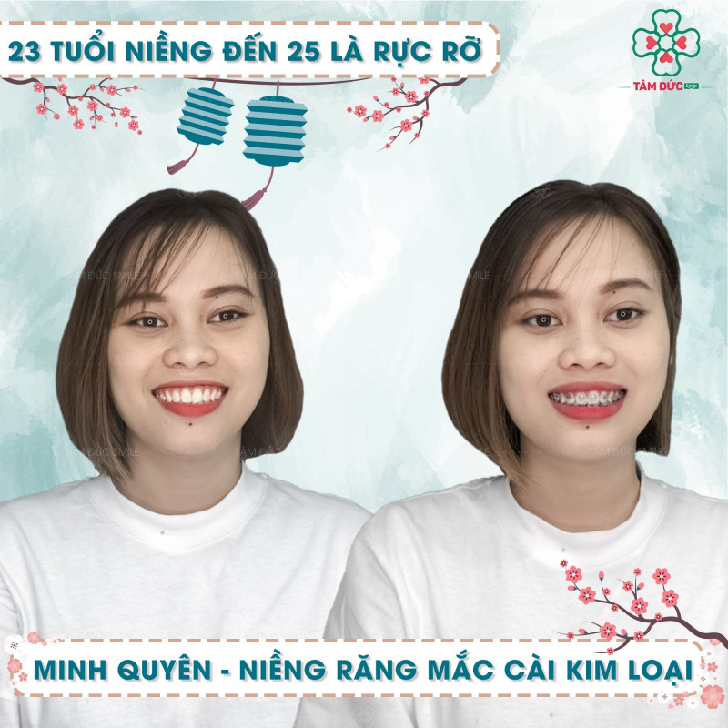 Nha khoa Tâm Đức Smile Vũng Tàu