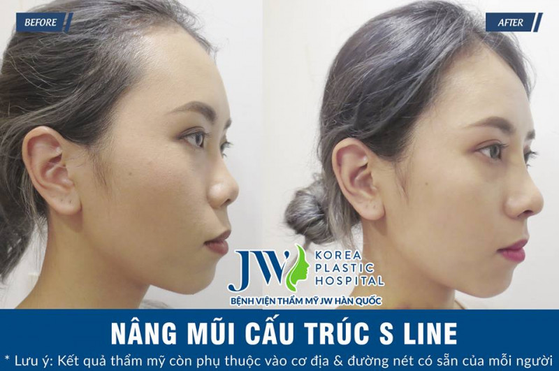 Bệnh viện phẫu thuật thẩm mỹ JW Hàn Quốc