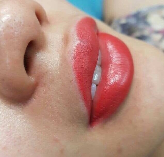 Phun môi với công nghệ candy lips tại thẩm mỹ Vân Anh