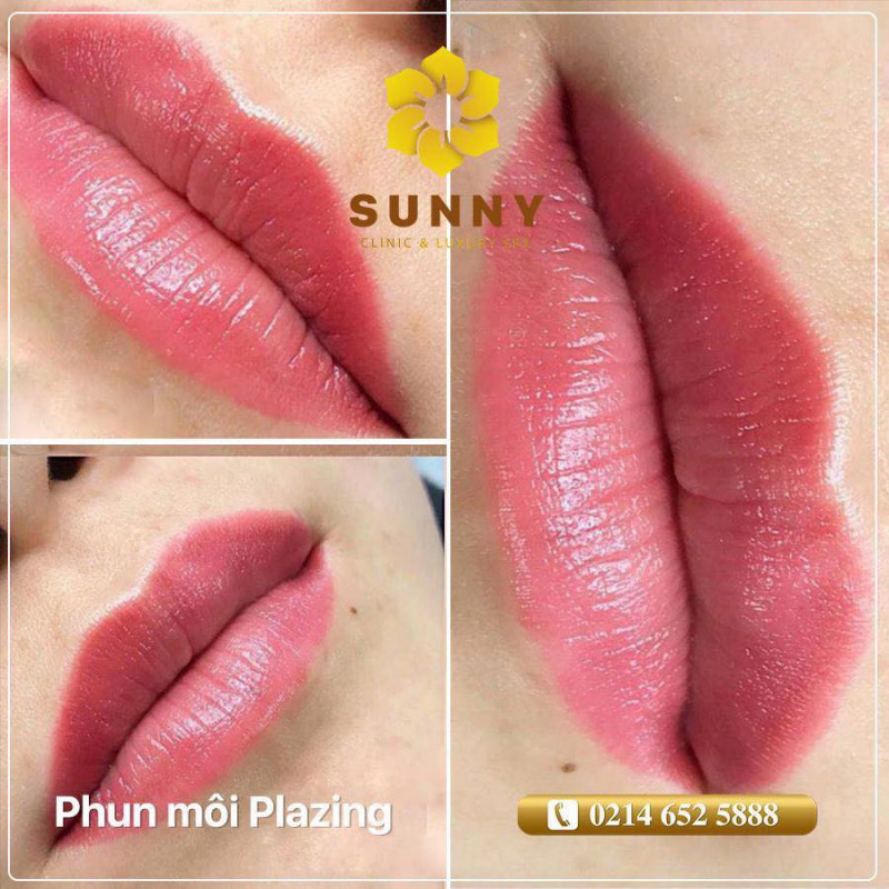 Viện Thẩm Mỹ Sunny