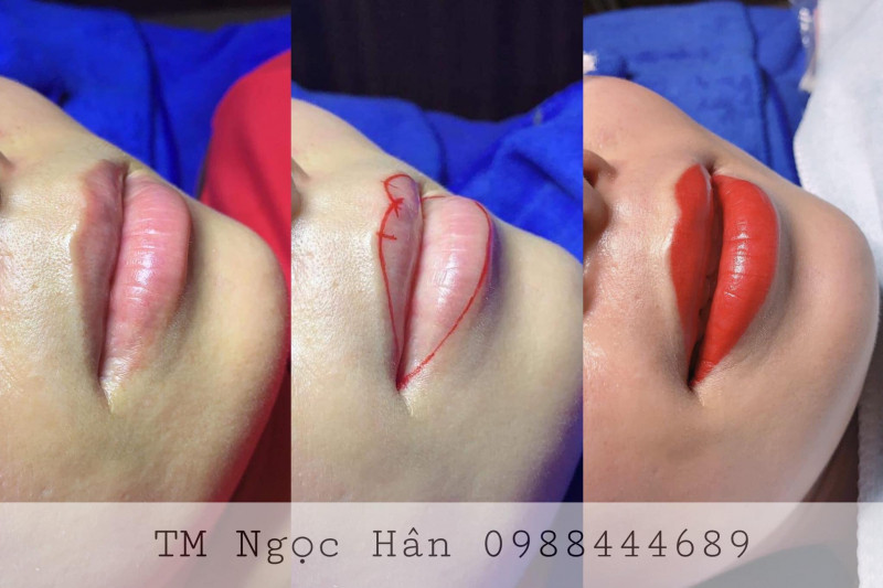 Thẩm Mỹ Ngọc Hân TiKi beauty