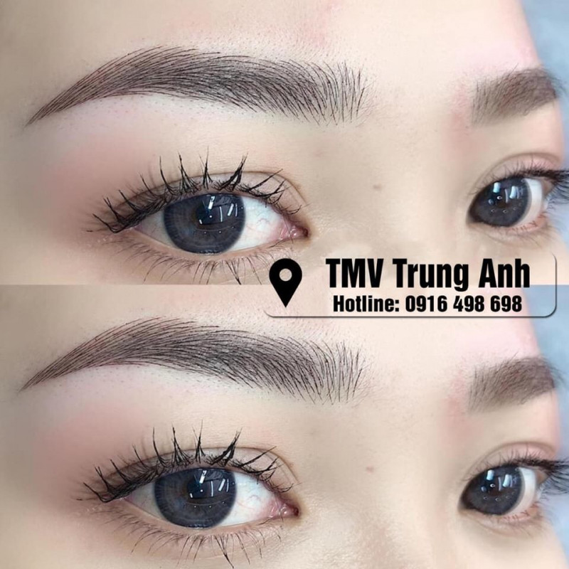 Thẩm Mỹ Viện Công Nghệ Cao Trung Anh