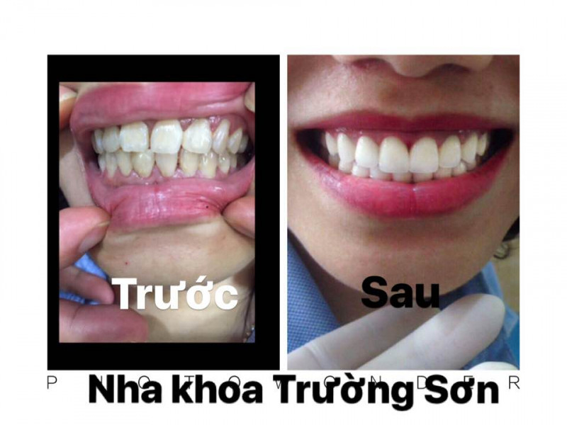 Nha Khoa Trường Sơn